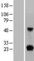 C9orf25 Protein (Over-Expression Lysate Myc-DDK (Flag))
