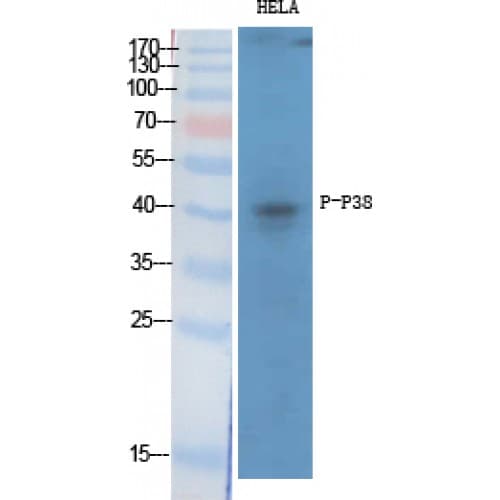 MAPK14 / p38 Antibody (120-200 aa)