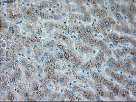 TRPM4 Antibody (clone OTI10H5)