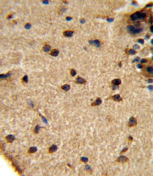 GLS / Glutaminase Antibody (aa516-545)