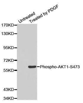 AKT1 Antibody (phospho-Ser473)