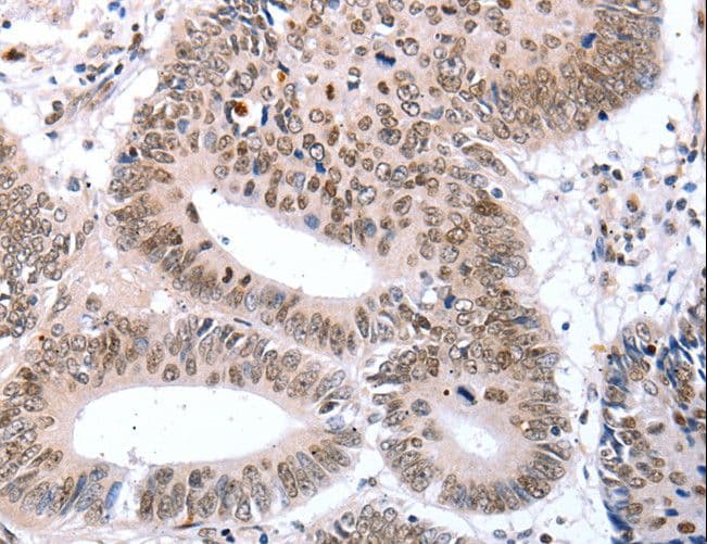 Polyclonal Rabbit anti-Human TBX2 Antibody (IHC)