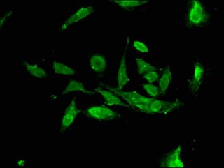 Polyclonal Rabbit anti-Human ALG13 Antibody (IF)