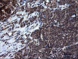RAB37 Antibody (clone OTI2F1)