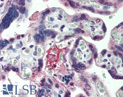 IHC-plus™ TRPC6 Antibody (aa350-400)