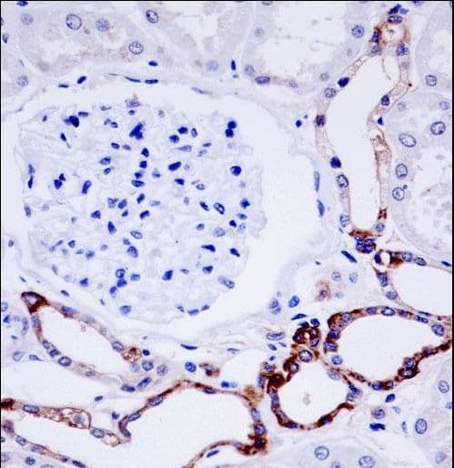 OTUD7B / Cezanne Antibody (aa757-784)