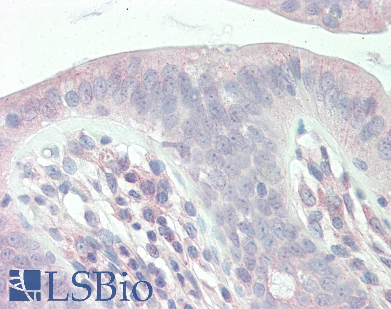 Polyclonal Rabbit anti-Human SLC9A1BP / CHP Antibody (aa35-84, IHC, WB)