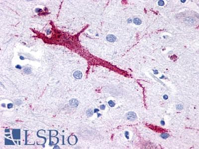 PathPlus™ ADGRF5 / GPR116 Antibody (N-Terminus)