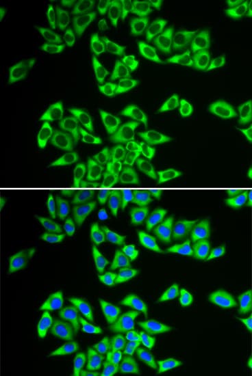 Polyclonal Rabbit anti-Human DDX3 / DDX3X Antibody (IHC, IF, WB)