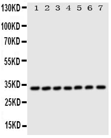 ECI1 / DCI Antibody (aa272-290)