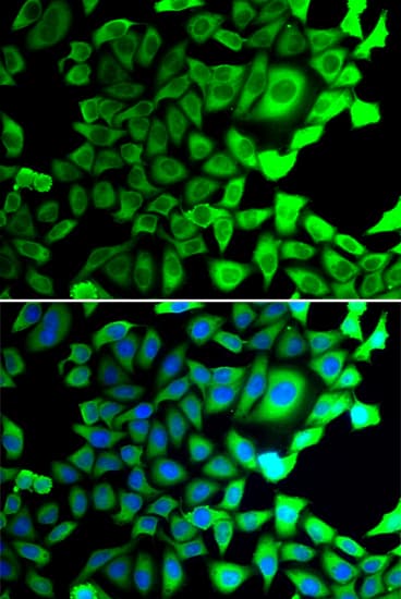 Polyclonal Rabbit anti-Human USP8 / UBPY Antibody (IHC, IF, WB)
