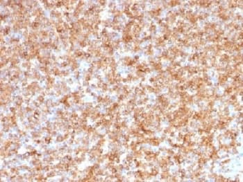 HLA-DP+DQ+DR Antibody (clone CR3/43)