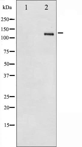 ITGB3 / Integrin Beta 3 / CD61 Antibody
