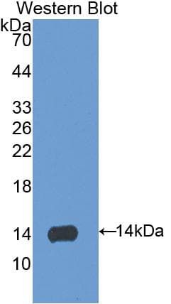 S100A9 / MRP14 Antibody (aa1-113)