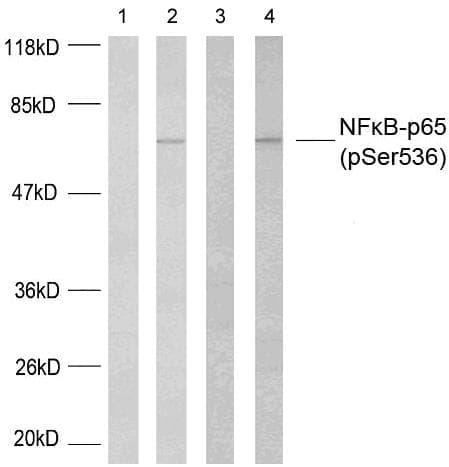 RELA / NFKB p65 Antibody (phospho-Ser536)