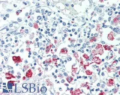 Polyclonal Rabbit anti-Human RPL11 / Ribosomal Protein L11 Antibody (IHC, IF)