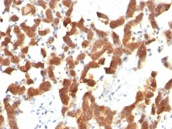 KRT18 / CK18 / Cytokeratin 18 Antibody (clone KRT18/834)