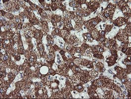 ACAA2 Antibody (clone OTI2H2)
