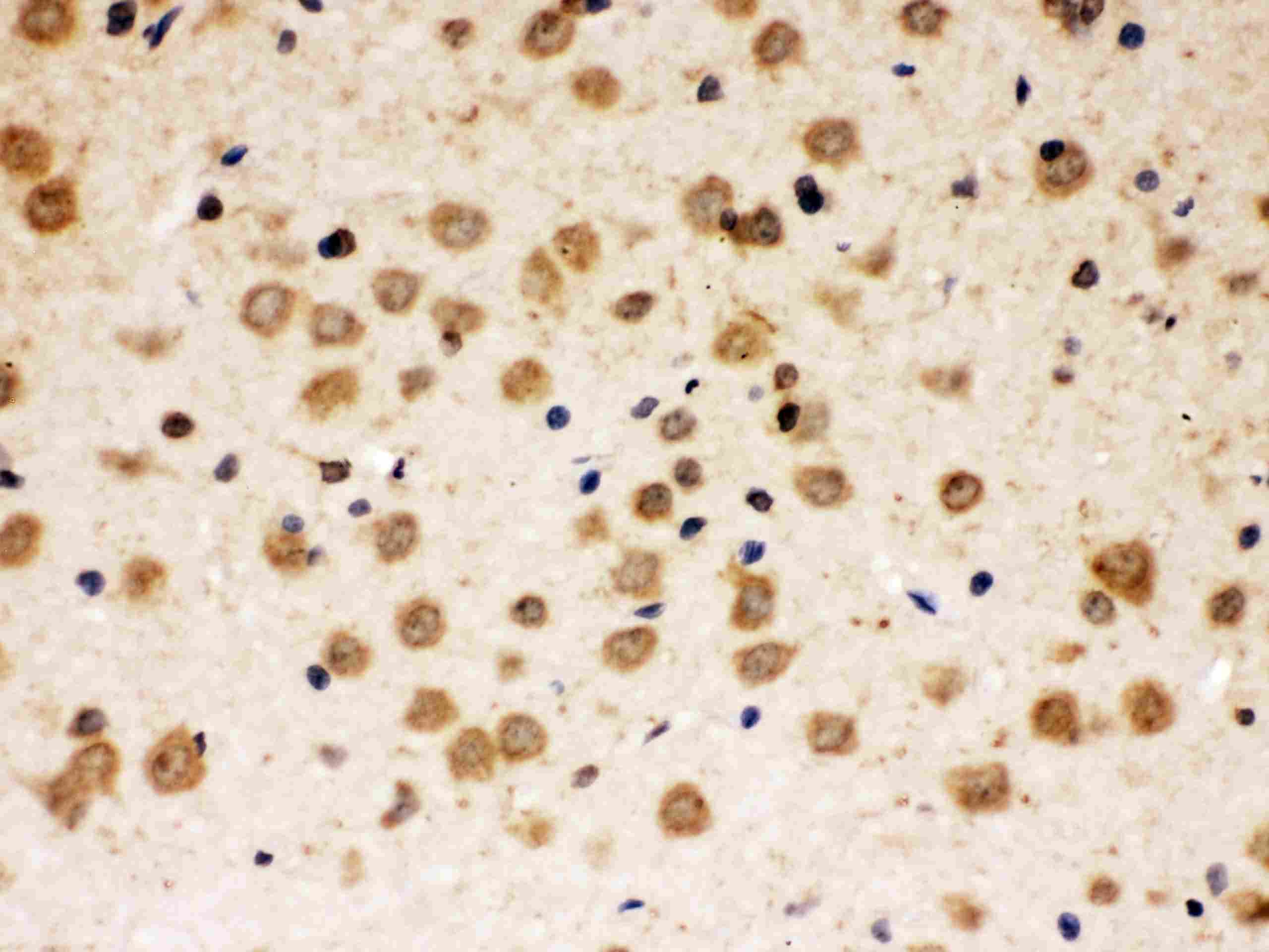 ABR Antibody