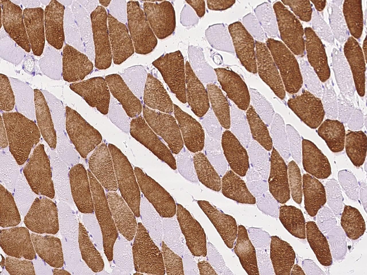 Polyclonal Rabbit anti-Human ATP2A2 / SERCA2 Antibody (IHC)