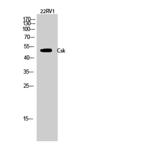 Polyclonal Rabbit anti-Human c-Src Kinase / CSK Antibody (300-380 aa, IHC, WB)