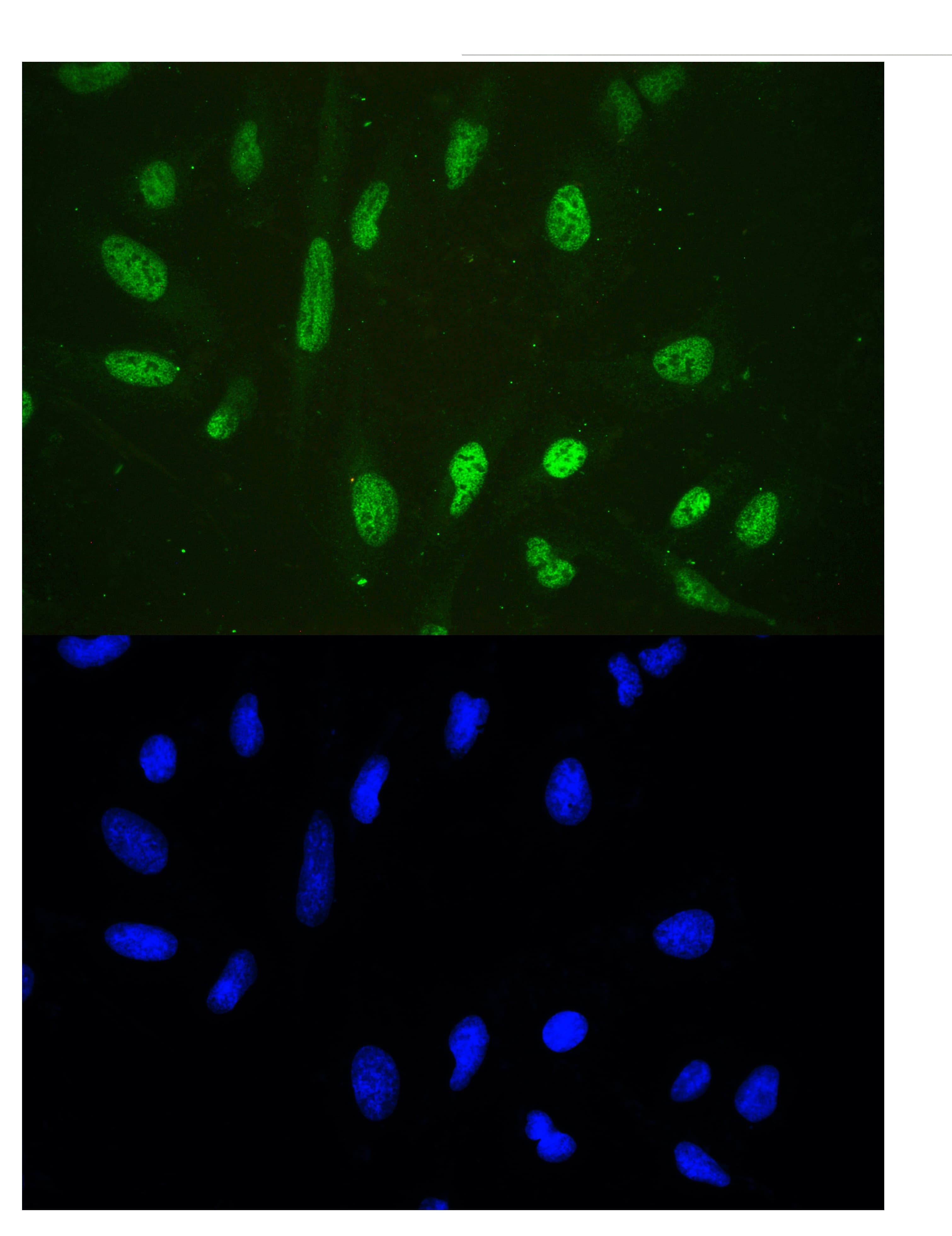 Polyclonal Rabbit anti-Human HDAC3 Antibody (aa1-18, IHC, WB)