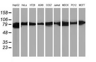 CTNNB1 / Beta Catenin Antibody (clone OTI12C1)