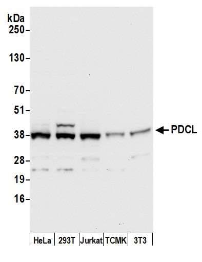 PDCL Antibody (aa1-50)