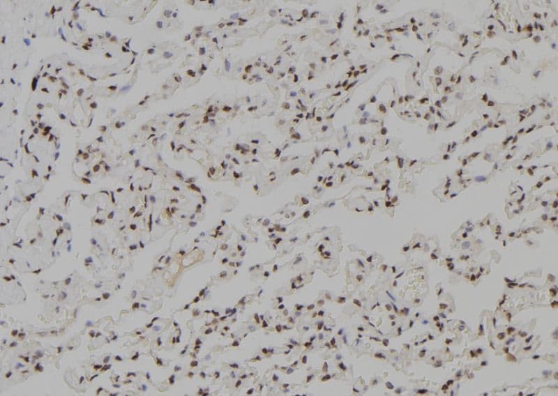 TGIF2LX Antibody