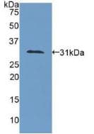 COL4A1 / Collagen IV Alpha1 Antibody (aa1444-1669, Biotin)