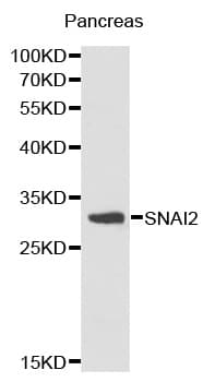Polyclonal Rabbit anti-Human SNAI2 / SLUG Antibody (IHC, IF, WB)