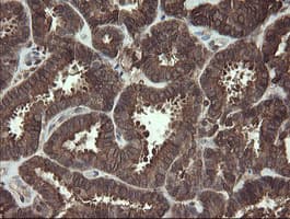 CXorf26 Antibody (clone OTI5A11)