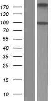 ALDH1L2 Protein (Over-Expression Lysate Myc-DDK (Flag))