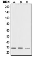 Polyclonal Rabbit anti-Human YWHAZ / 14-3-3 Zeta Antibody (Internal, IHC, IF, WB)