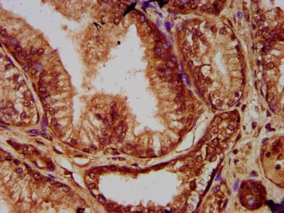 EVC2 Antibody