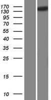 SCAPER Protein (Over-Expression Lysate Myc-DDK (Flag))