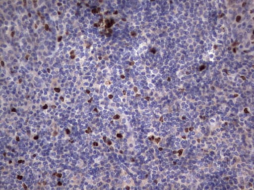 MKI67 / Ki67 Antibody (aa1160-1493, clone OTI1D9)