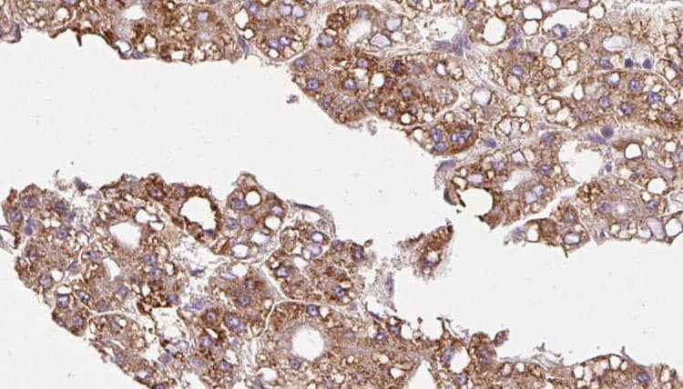 CDC42BPB / MRCKB Antibody