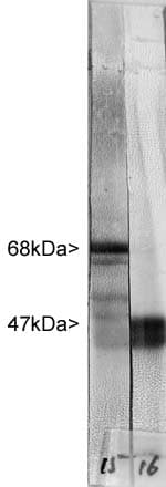 Polyclonal Rabbit anti-Human NF-L / NEFL Antibody (IHC, IF, WB)