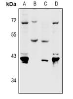 PVRL4 / Nectin 4 Antibody