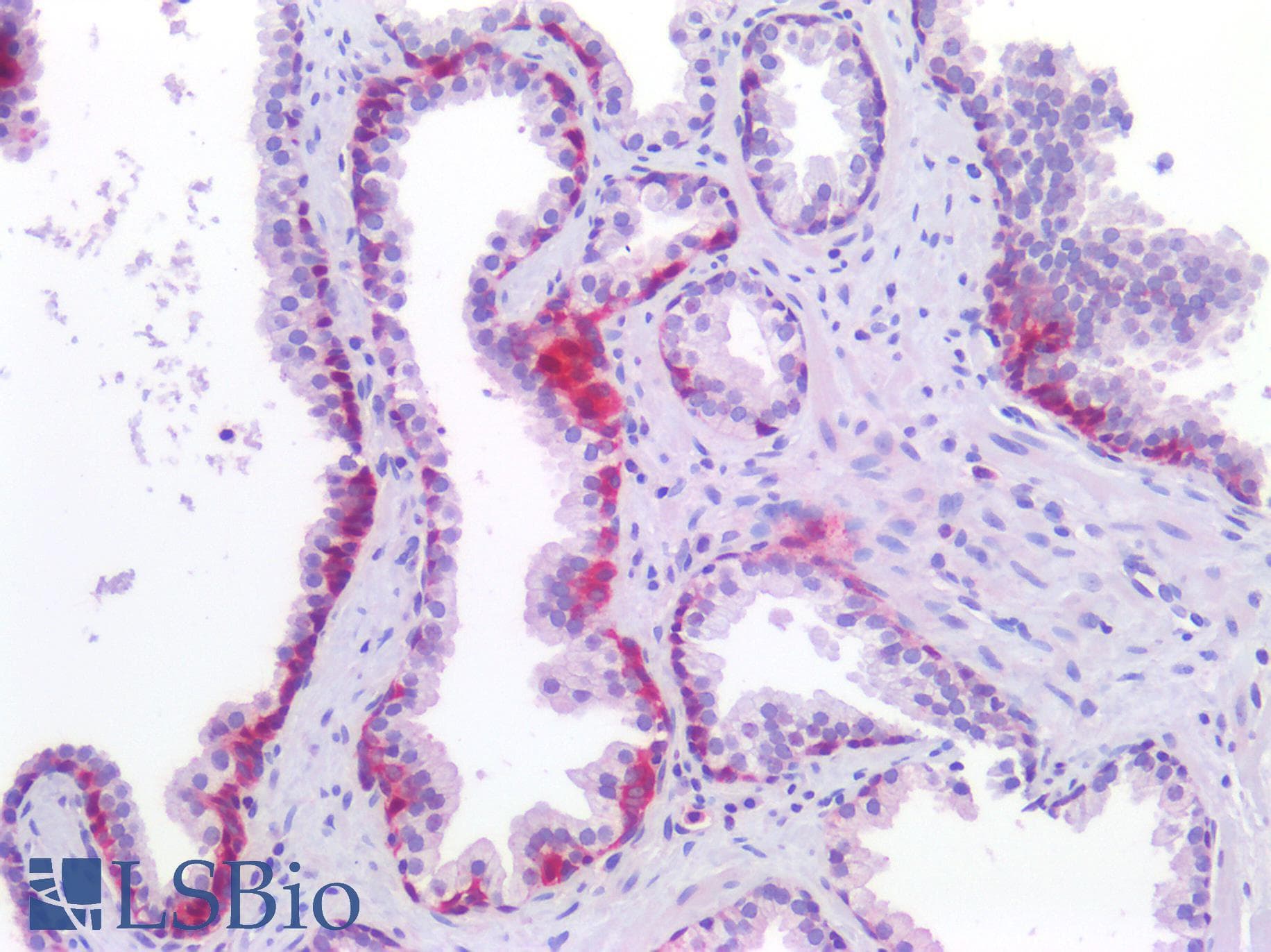 PathPlus™ Polyclonal Rabbit anti-Human SMN1 Antibody (aa45-94, IHC, WB)