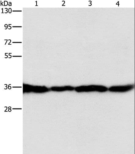 GNB1 Antibody