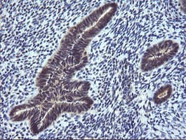 CTAG1B / NY-ESO-1 Antibody (clone OTI3H8, Carrier-free)