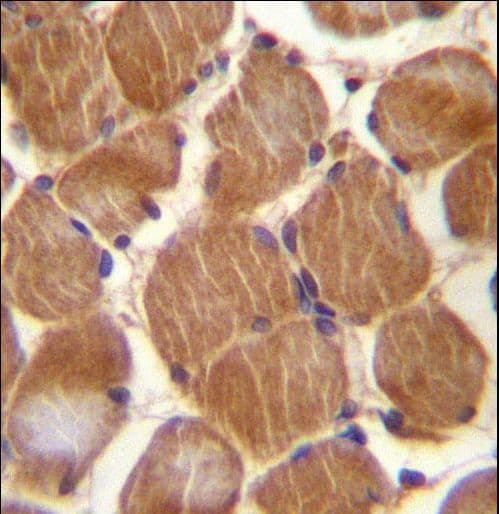 Polyclonal Rabbit anti-Human CLMP / ACAM Antibody (aa81-110, IHC, WB)
