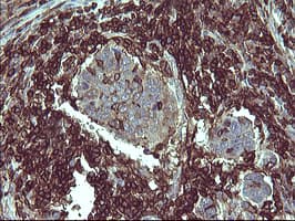CD45 / LCA Antibody (clone OTI1F6)