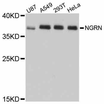 Polyclonal Rabbit anti-Human DSC92 / NGRN Antibody (WB)