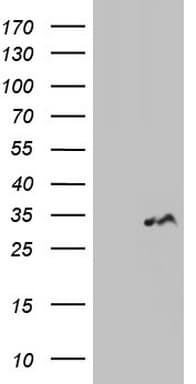 LGALS3 / Galectin 3 Antibody (clone OTI21C1)