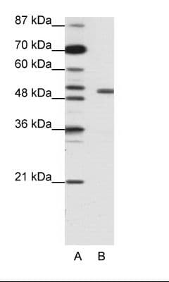 Polyclonal Rabbit anti-Human KCNAB2 / Kv-Beta-2 Antibody (aa121-170, IHC, WB)