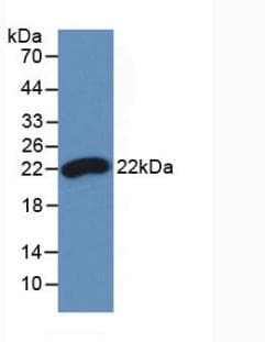 IFN Beta / Interferon Beta Antibody