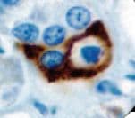 PRL / Prolactin Antibody (clone PRL02)